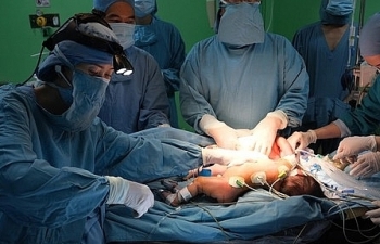 Phẫu thuật tách thành công cặp song sinh nữ dính liền nhau nhỏ tuổi nhất